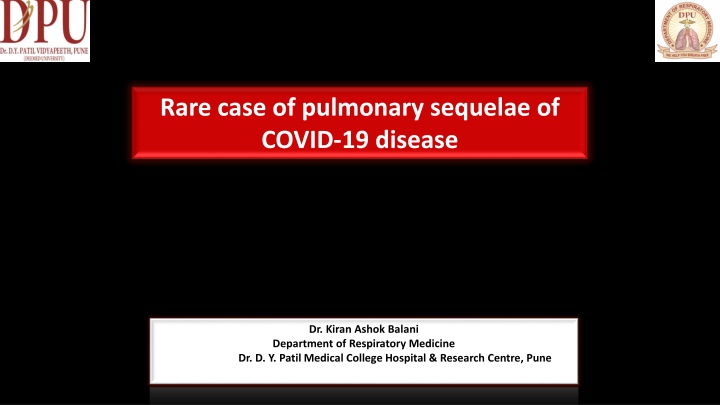 rare case of pulmonary sequelae of covid