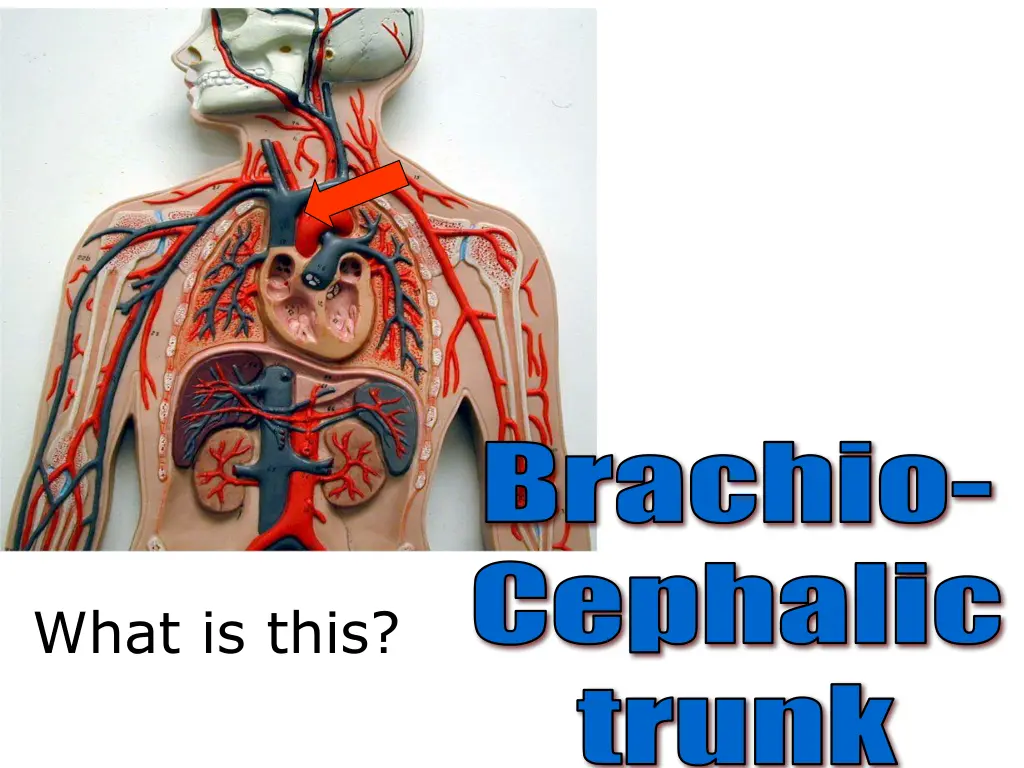 brachio cephalic 1