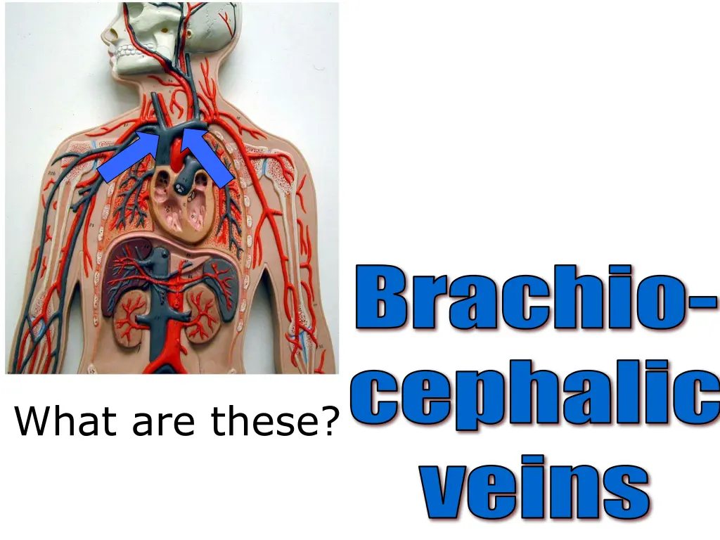brachio cephalic