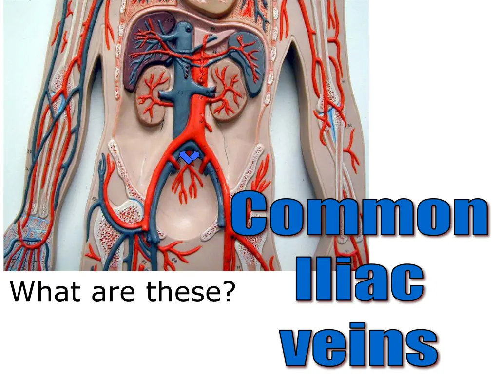 common iliac 1