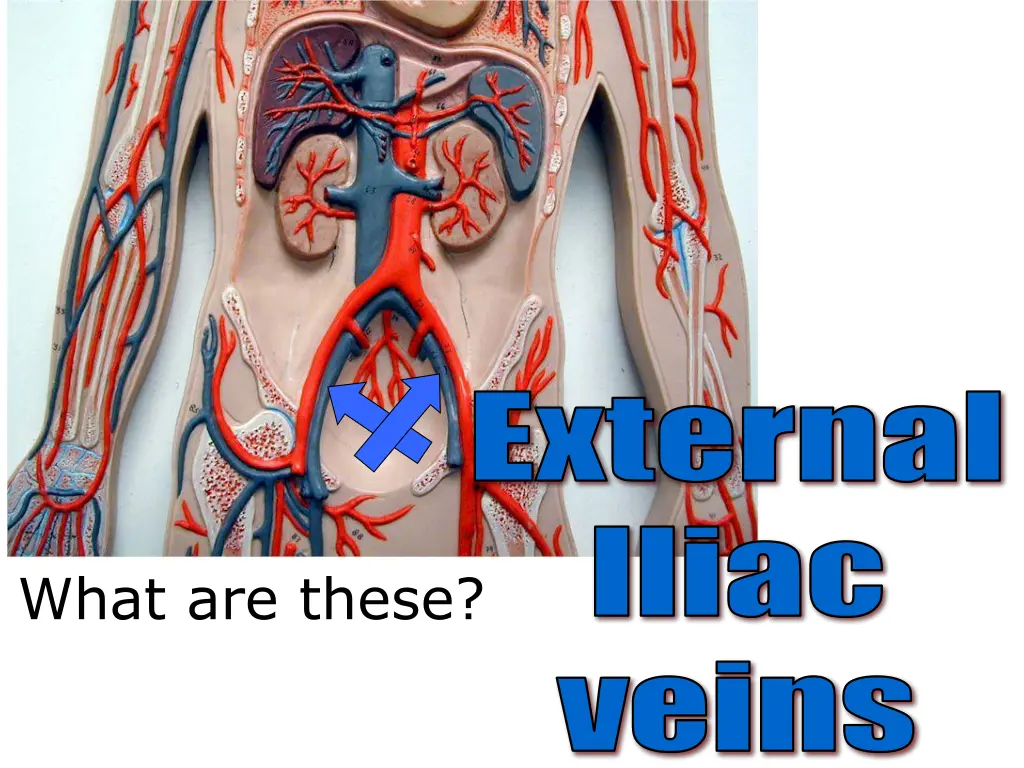 external iliac 1