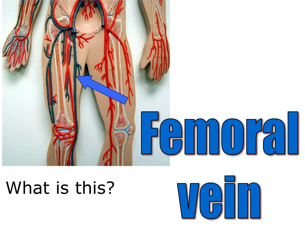femoral 1