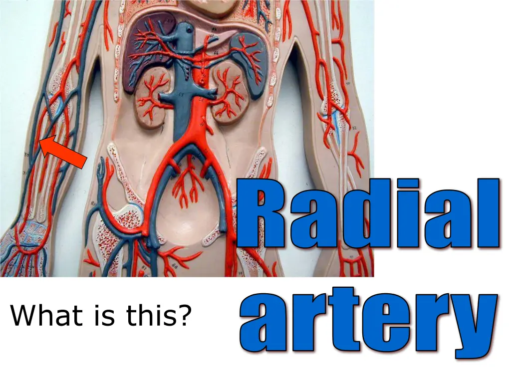 radial 1