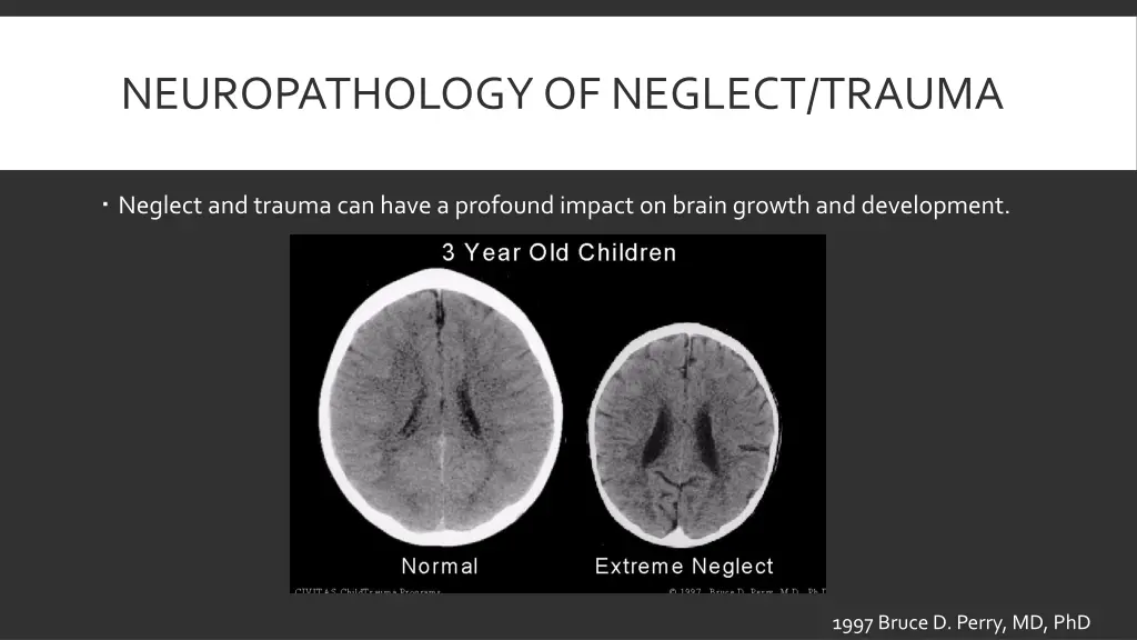 neuropathology of neglect trauma