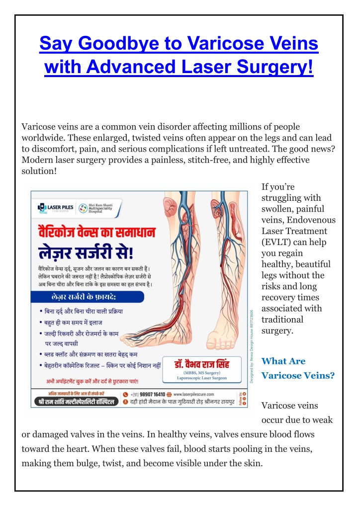 say goodbye to varicose veins with advanced laser