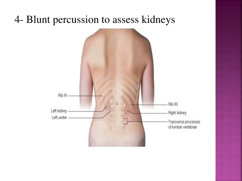 4 blunt percussion to assess kidneys