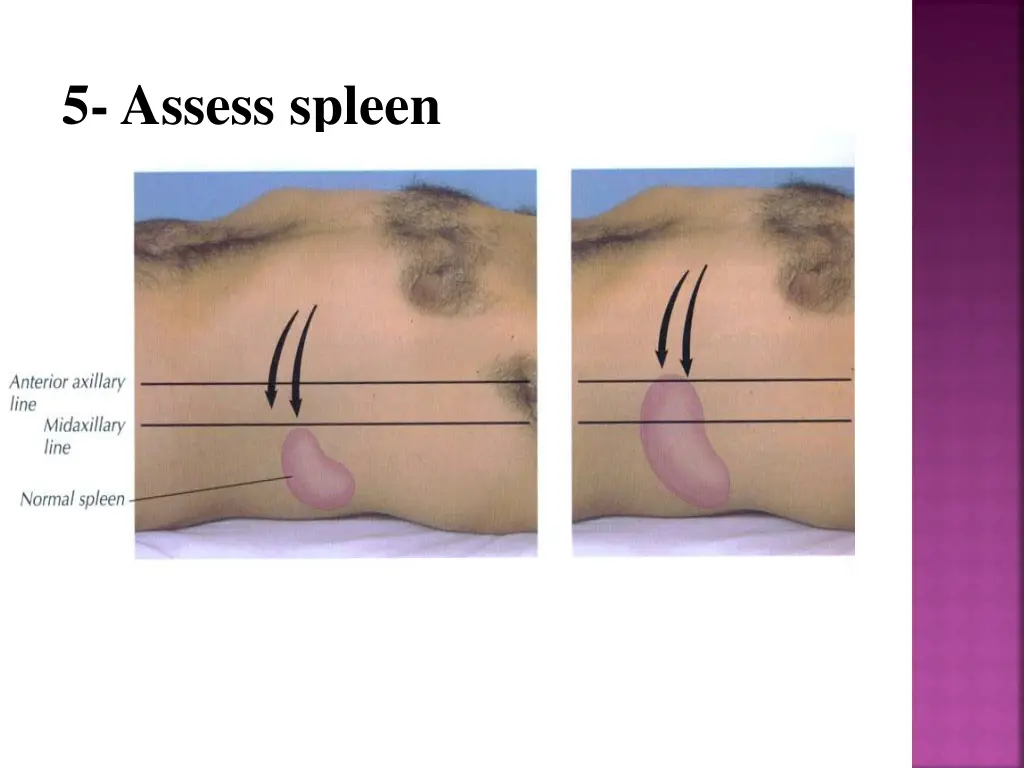 5 assess spleen