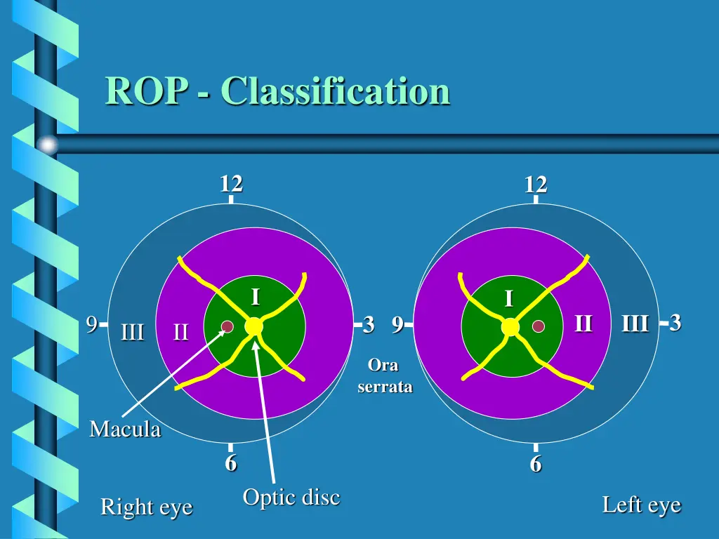 rop classification 1