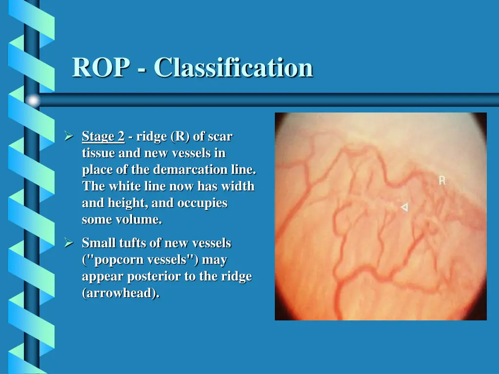 rop classification 2