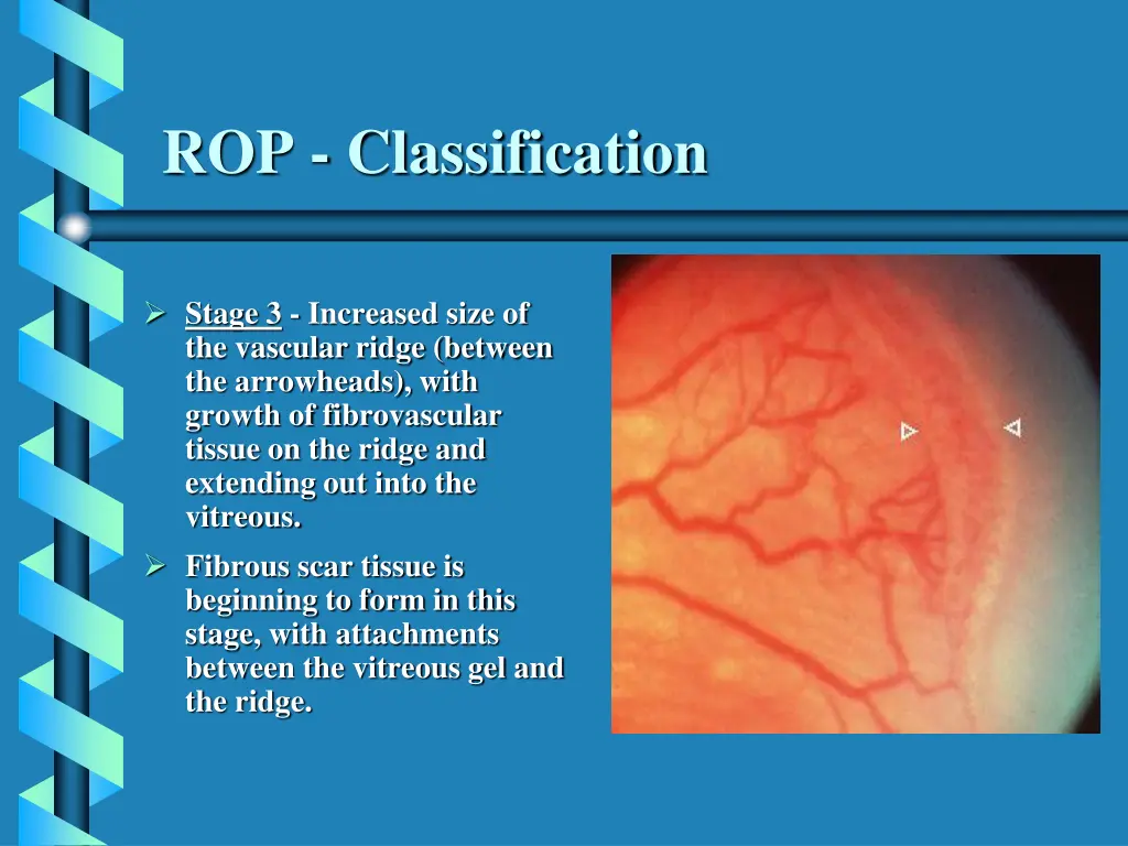 rop classification 3
