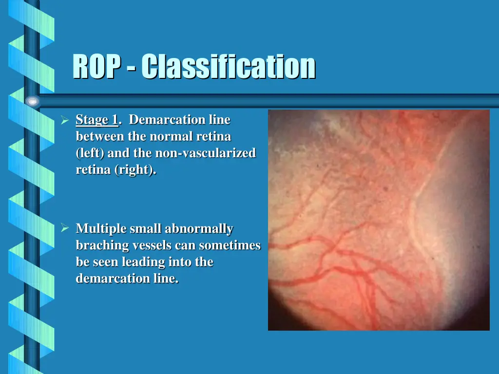 rop classification rop classification