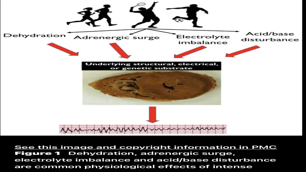 slide12