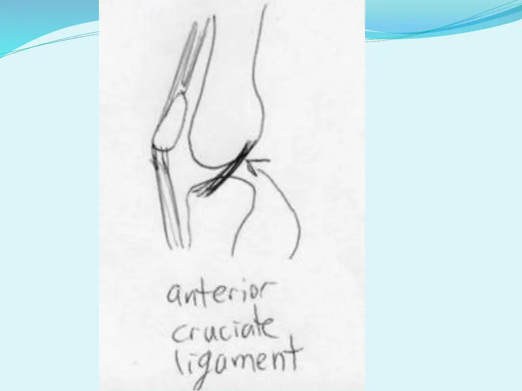 slide23
