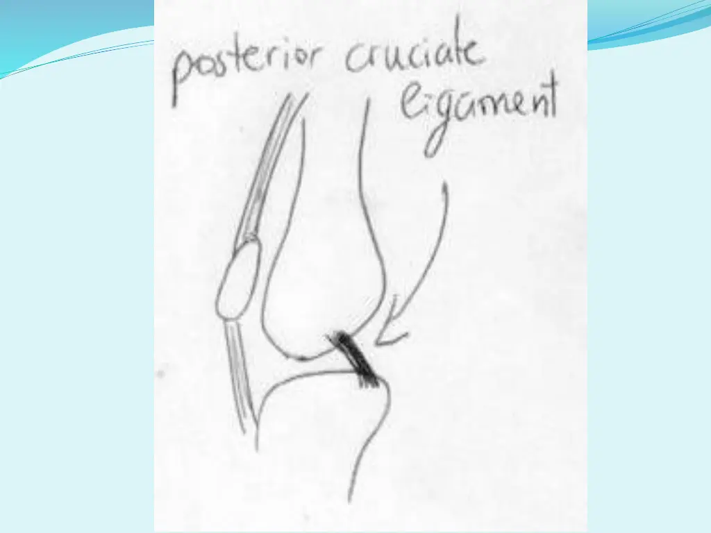 slide29