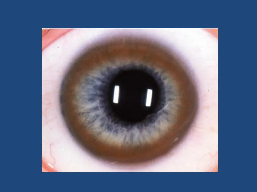 slide16