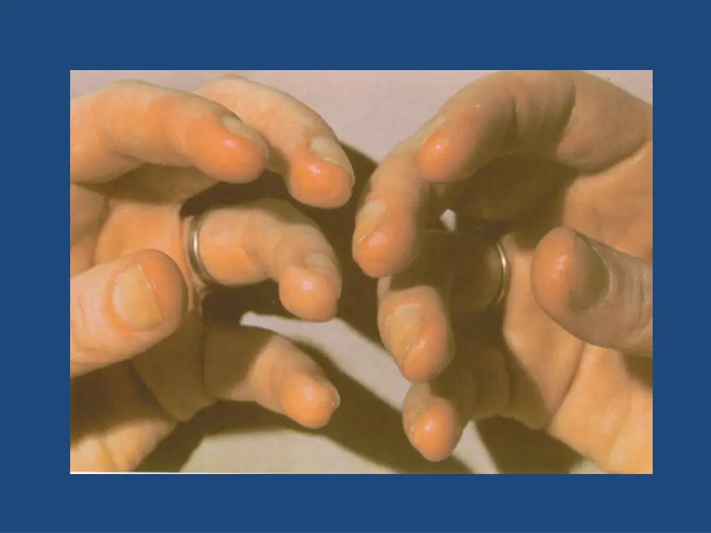 slide7
