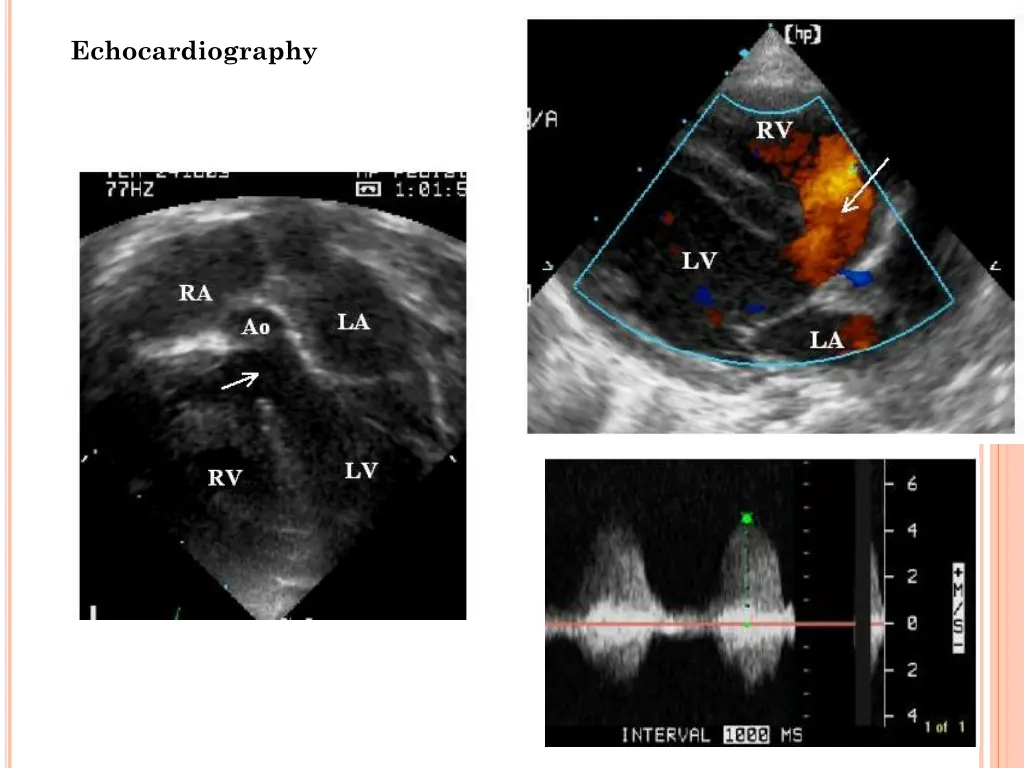 echocardiography 1