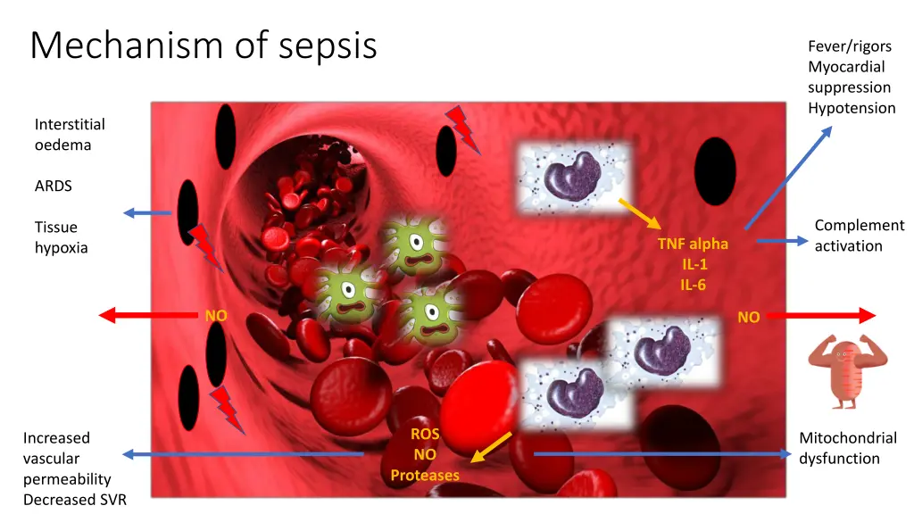 mechanism of sepsis