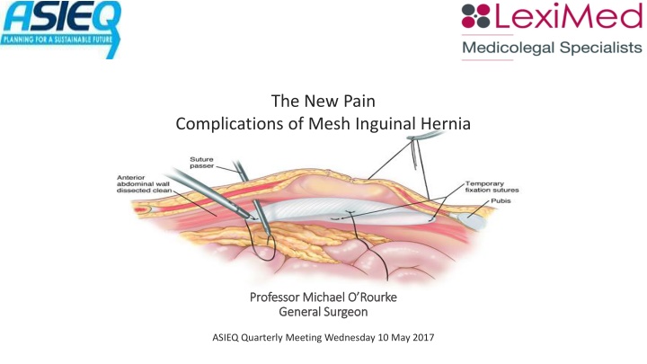 the new pain