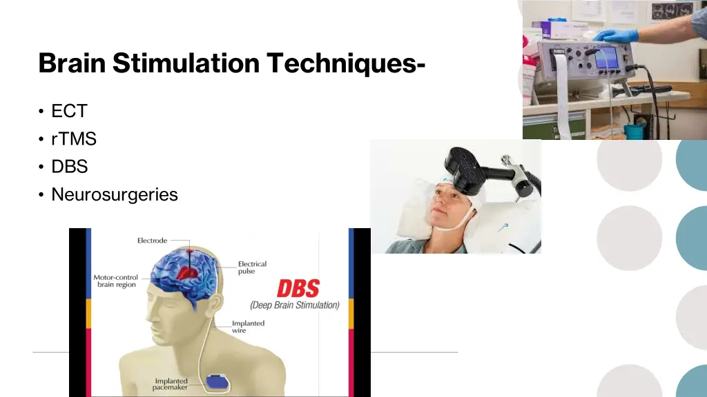 brain stimulation techniques