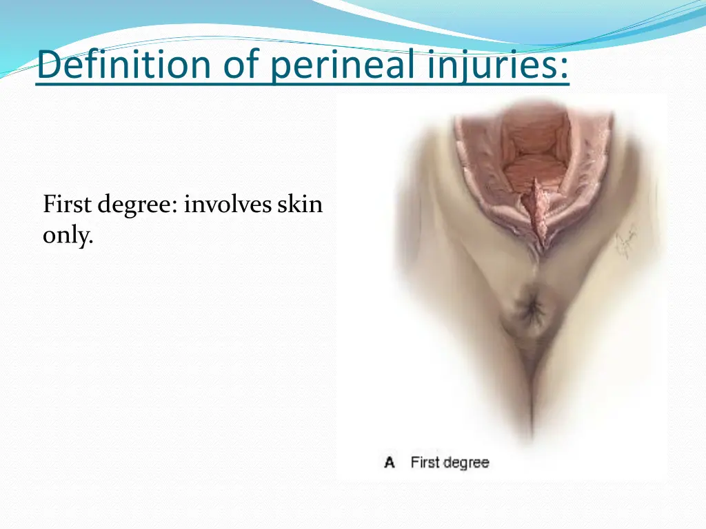definition of perineal injuries