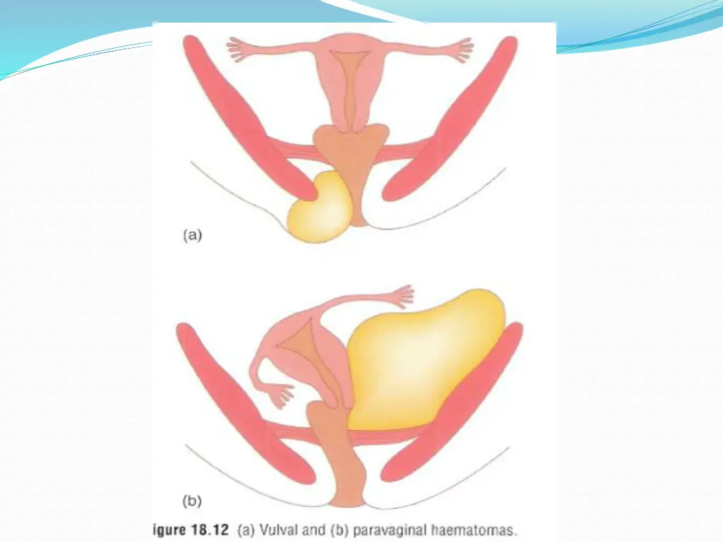 slide12