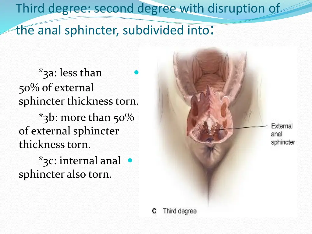 third degree second degree with disruption