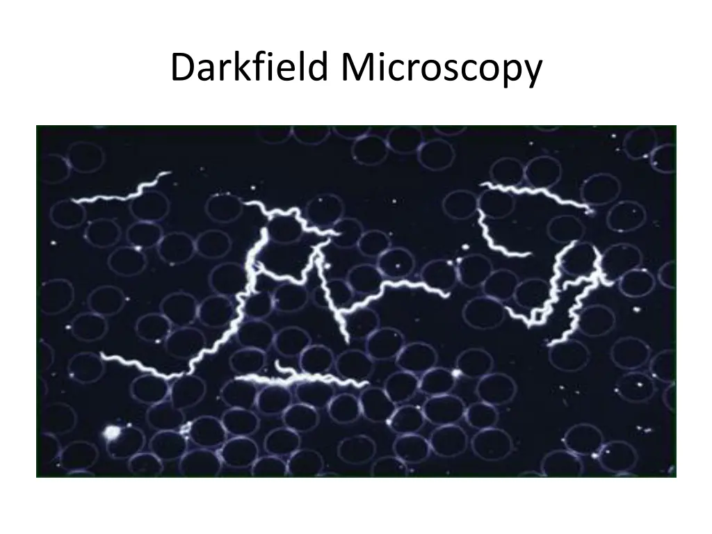 darkfield microscopy