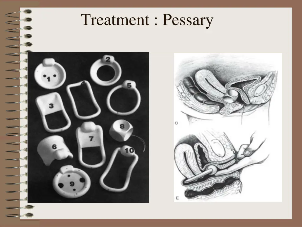 treatment pessary