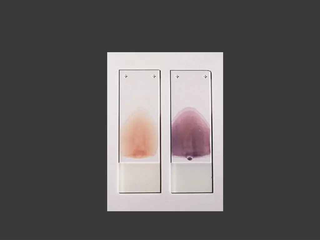 slide6
