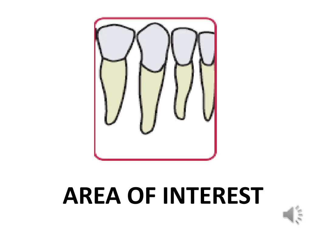 area of interest