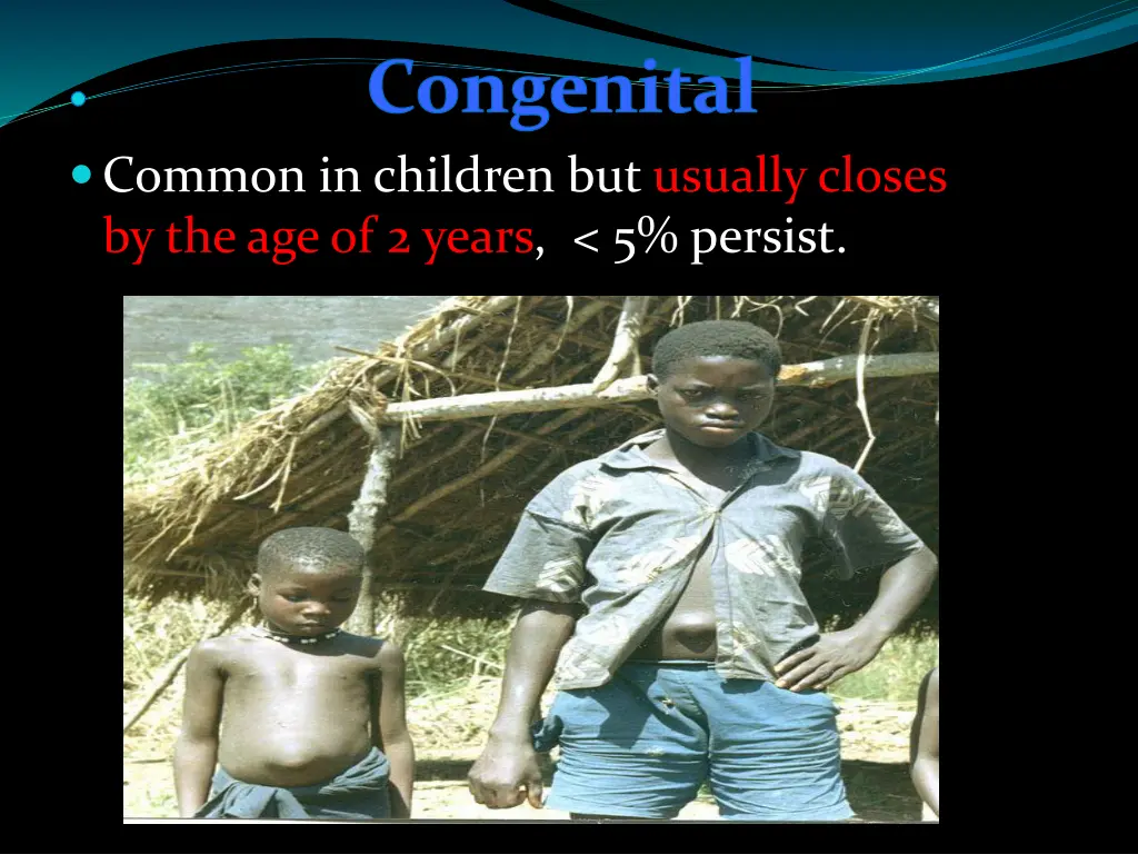 congenital