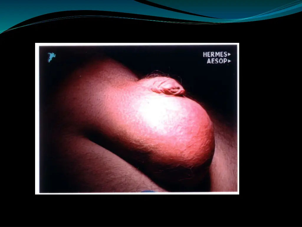 slide18