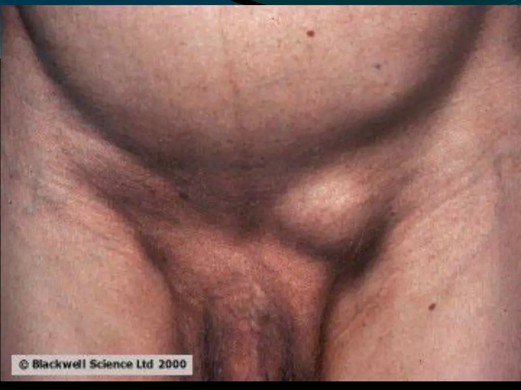 slide24
