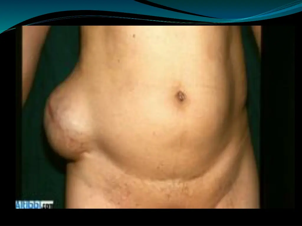 slide27