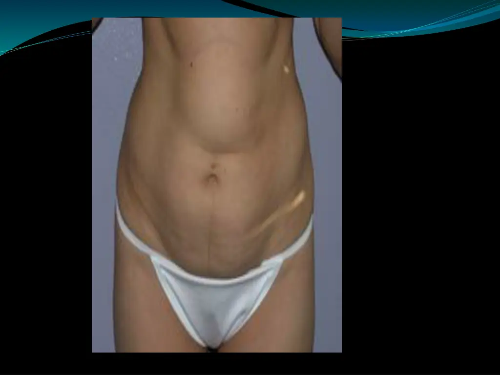 slide29
