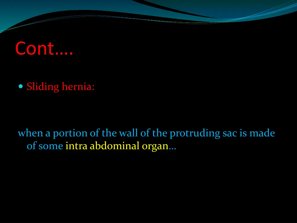 slide33