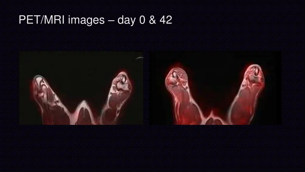 pet mri images day 0 42