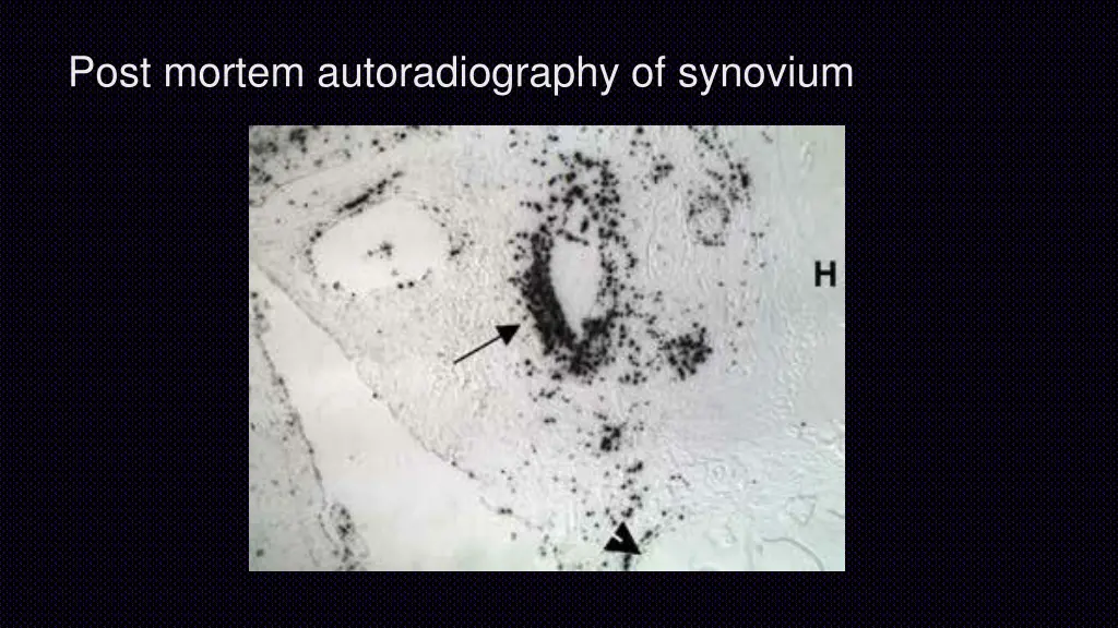 post mortem autoradiography of synovium