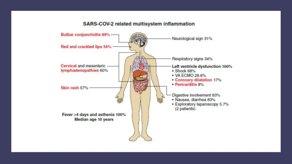 slide12