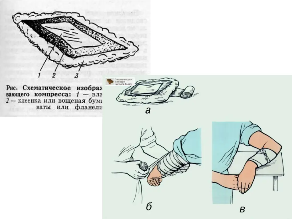 slide20