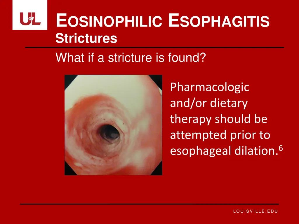 e osinophilic e sophagitis 12