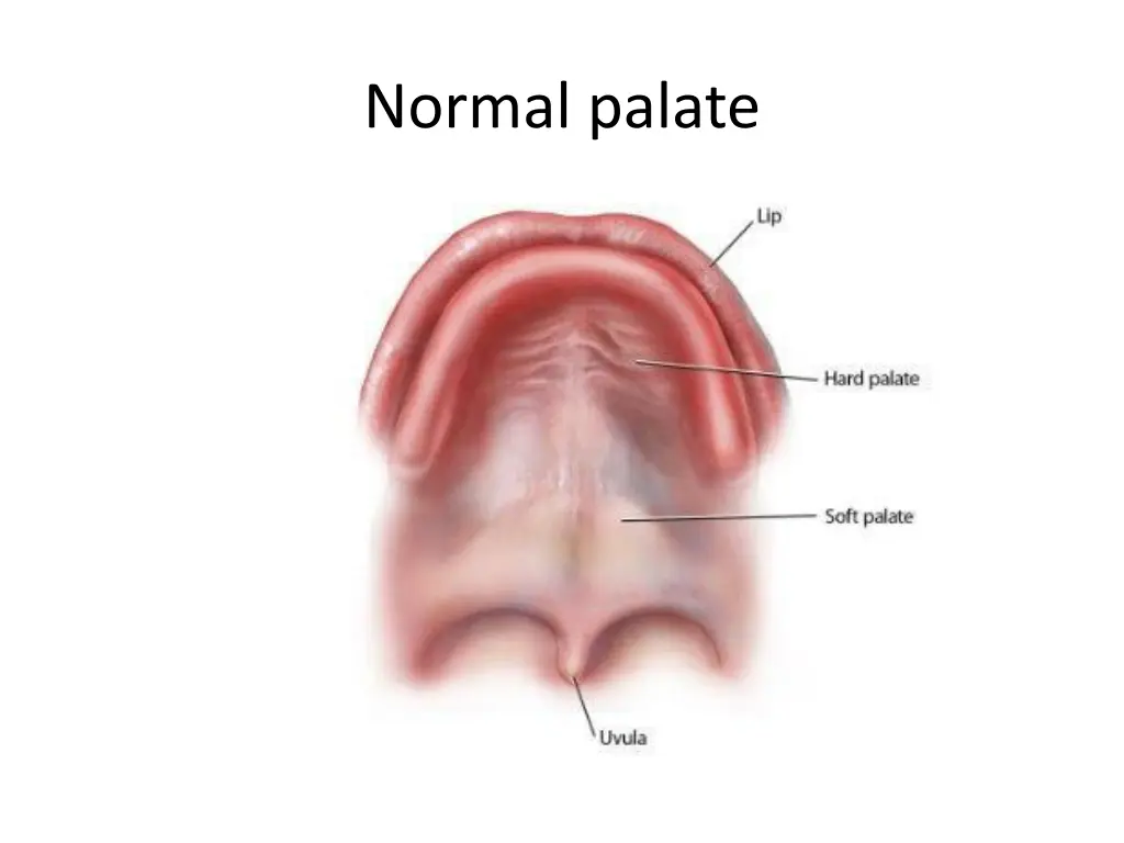 normal palate