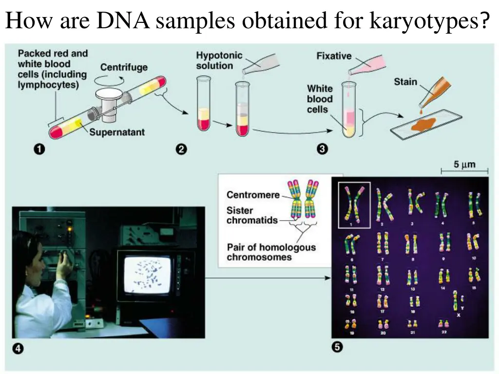 how are dna samples obtained for karyotypes