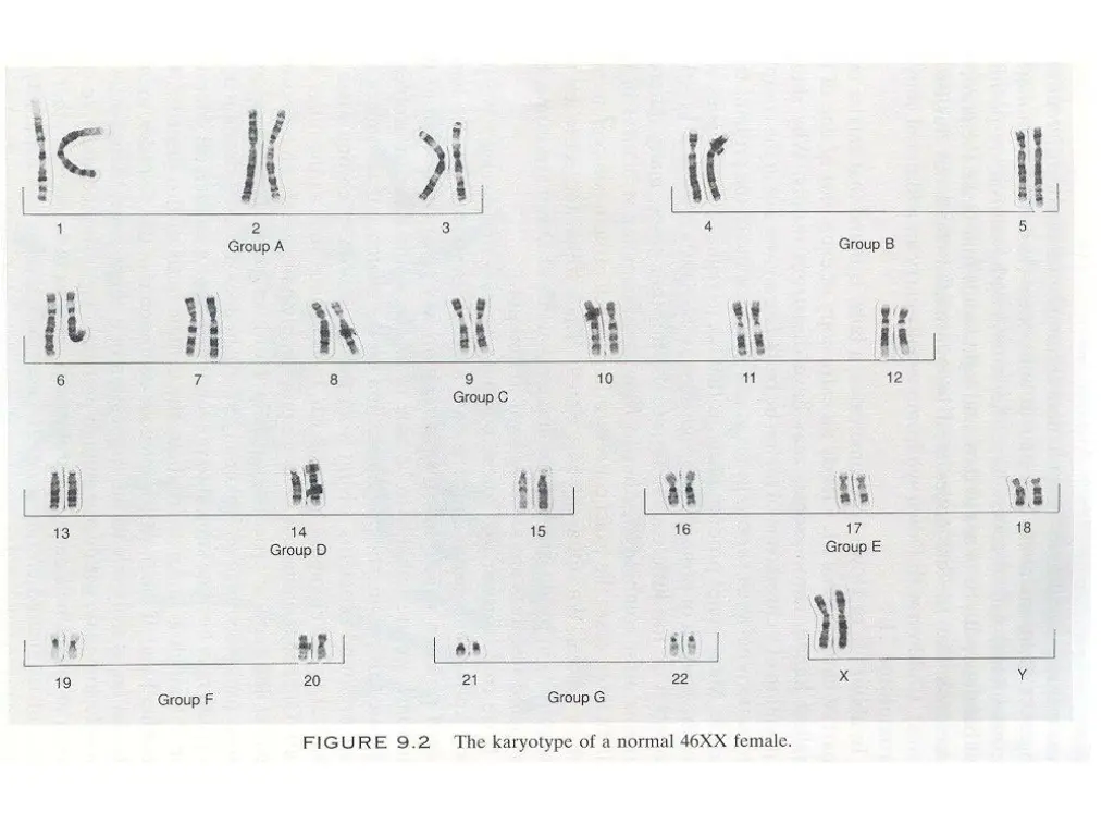 slide12