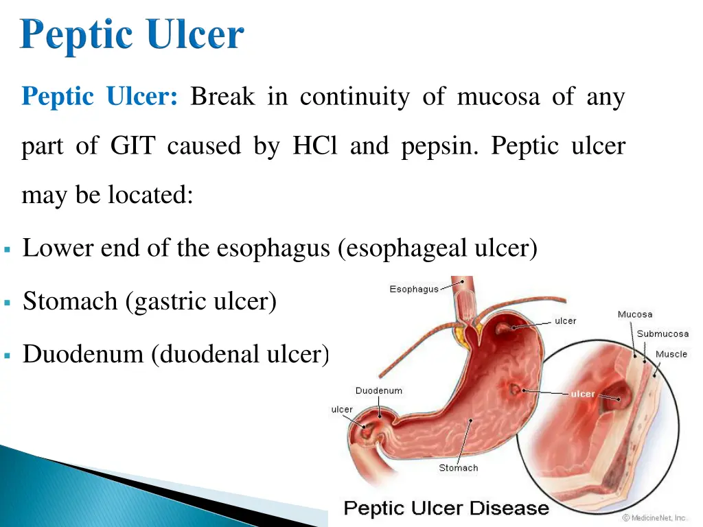 peptic ulcer break in continuity of mucosa of any