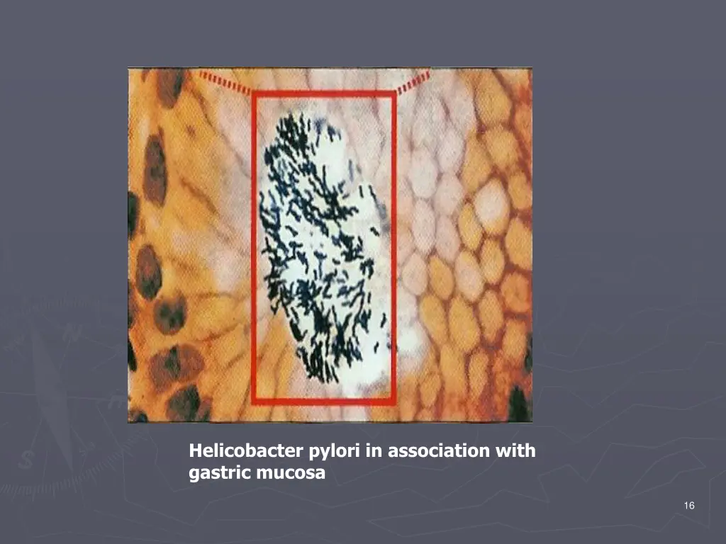helicobacter pylori in association with gastric