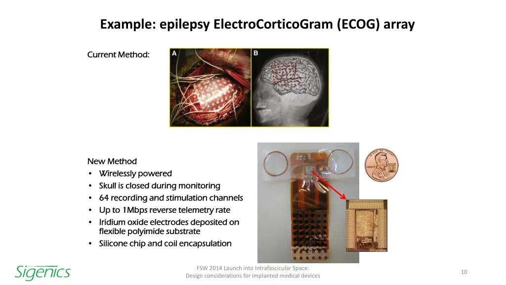 example epilepsy electrocorticogram ecog array
