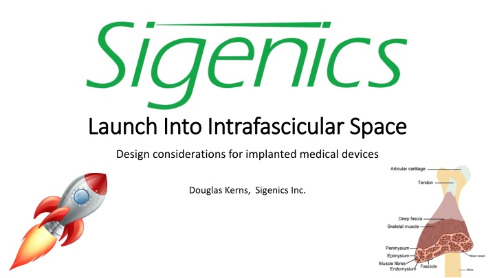 launch into launch into intrafascicular