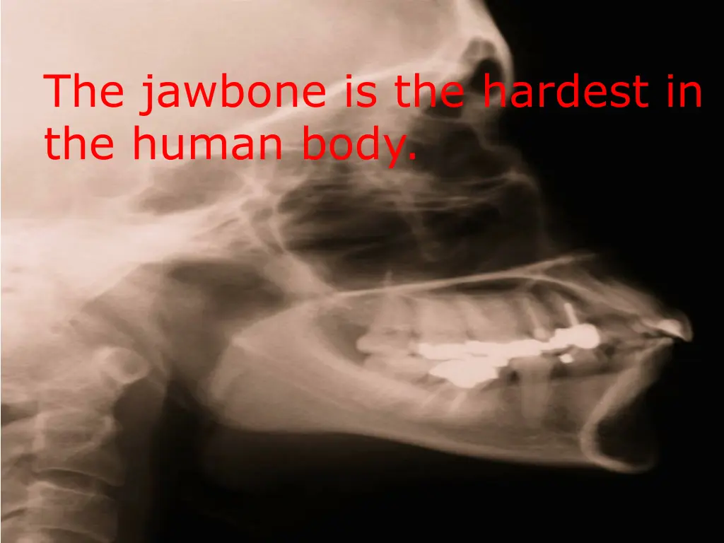 the jawbone is the hardest in the human body